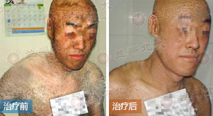 ���ݱ���Ƥ����