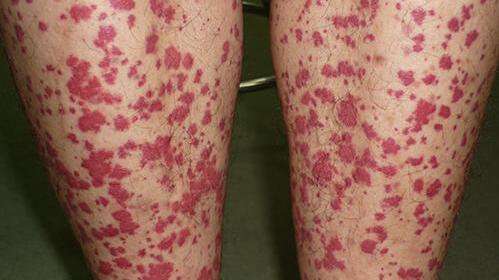 ���ݱ���Ƥ����