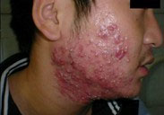 ���ݱ���Ƥ����