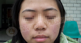 ���ݱ���Ƥ����