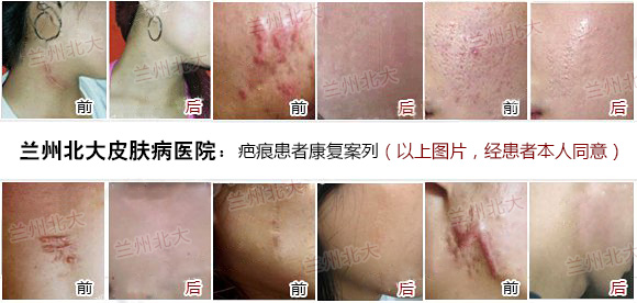 ���ݱ���Ƥ����