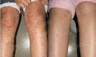 ���ݱ���Ƥ����