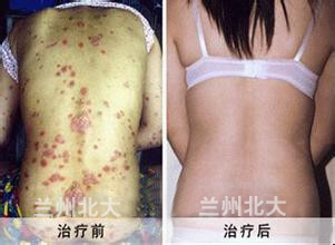 ���ݱ���Ƥ����