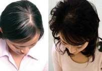 ���ݱ���Ƥ����