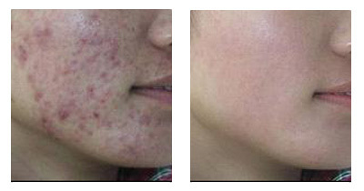 ���ݱ���Ƥ����