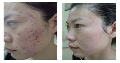 ���ݱ���Ƥ����