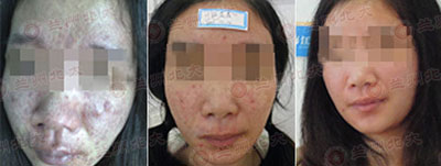 ���ݱ���Ƥ����