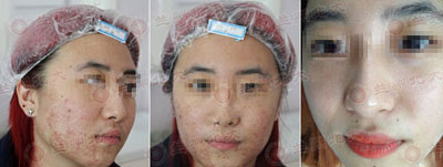 ���ݱ���Ƥ����