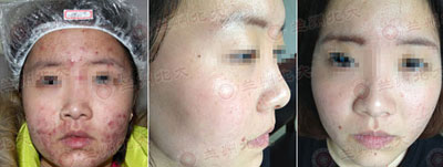 ���ݱ���Ƥ����