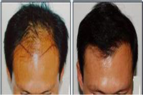 ���ݱ���Ƥ��ר����Щ��ʱ��ֲ��